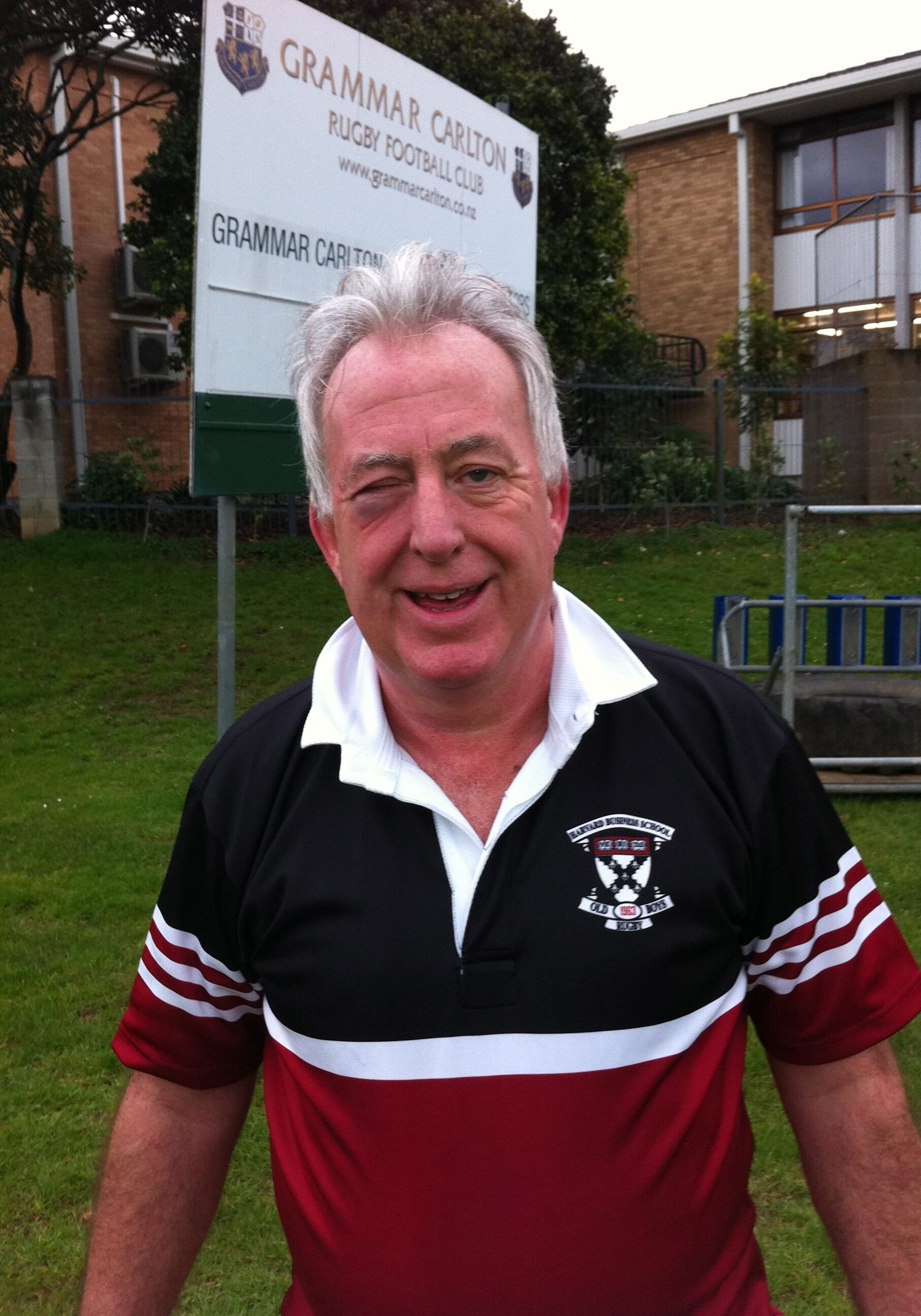 Ian Fraser